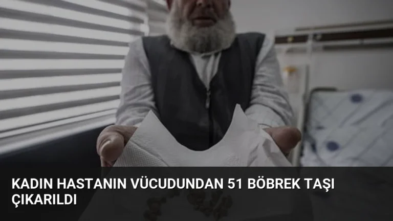 Kadın Hastanın Vücudundan 51 Böbrek Taşı Çıkarıldı