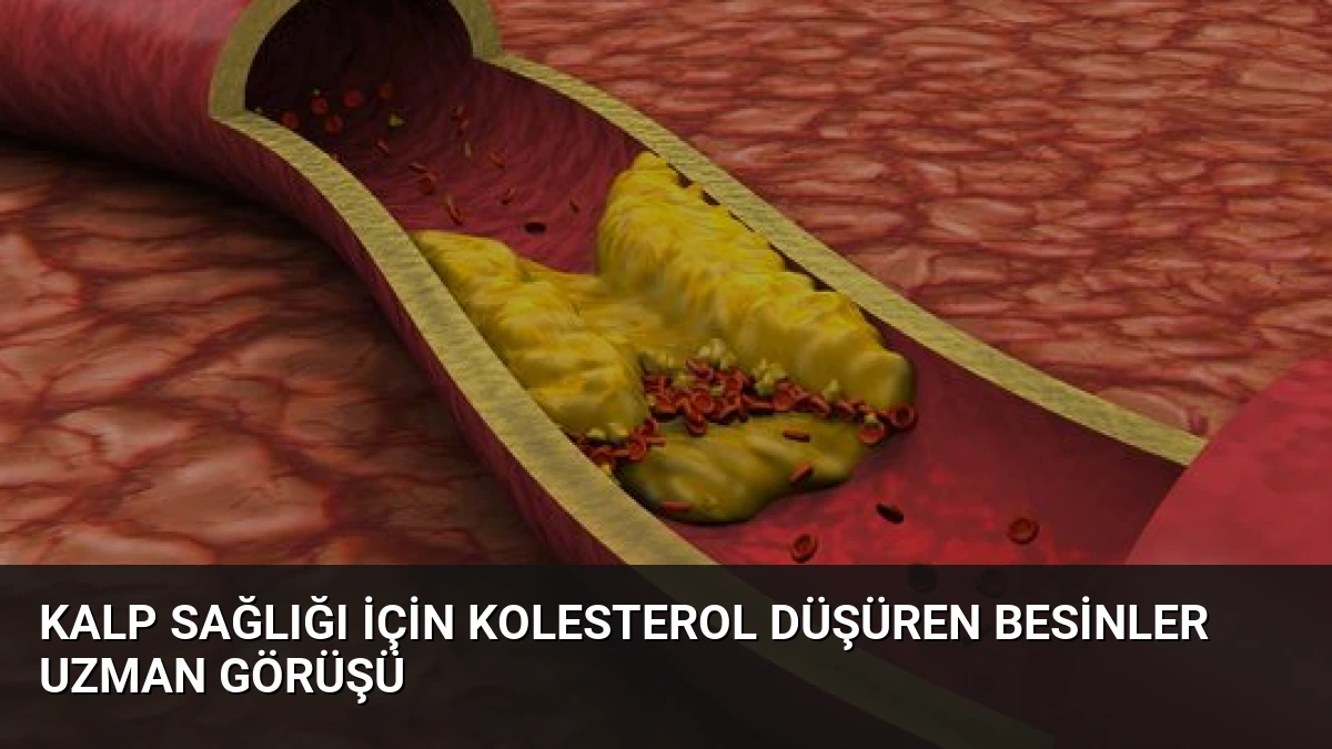 Kalp Sağlığı İçin Kolesterol Düşüren Besinler Uzman Görüşü