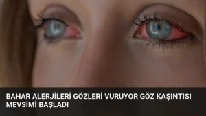 Bahar Alerjileri Gözleri Vuruyor Göz Kaşıntısı Mevsimi Başladı