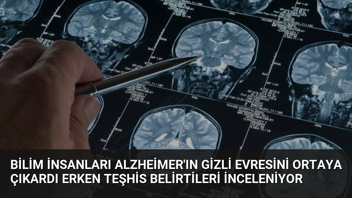 Bilim İnsanları Alzheimer’ın Gizli Evresini Ortaya Çıkardı Erken Teşhis Belirtileri İnceleniyor