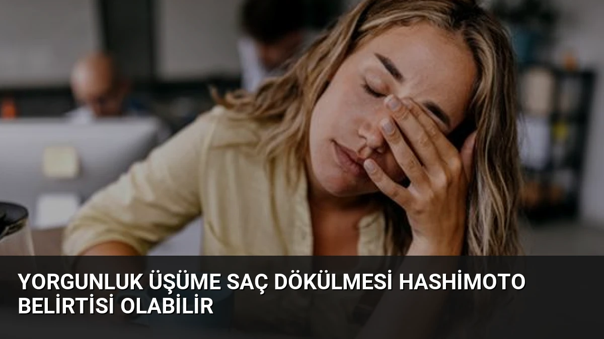 Yorgunluk Üşüme Saç Dökülmesi Hashimoto Belirtisi Olabilir